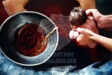 Floating Placenta - Copyright 2004 Birth Balance